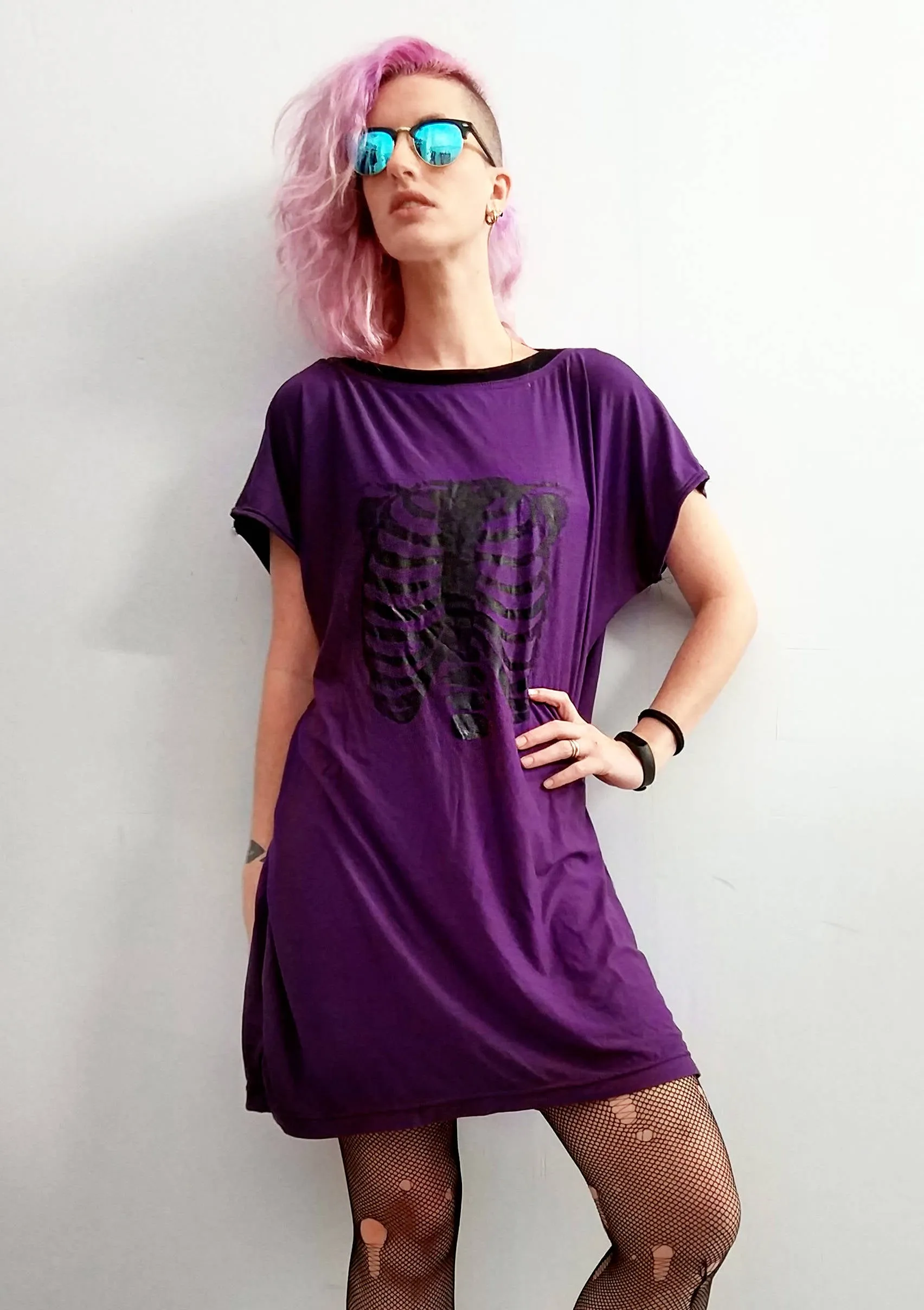 Ribcage print mini t shirt dress